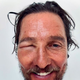 Matthew McConaughey s fotografijo zatečenega očesa prestrašil oboževalce