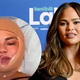 Chrissy Teigen: Opravila sem poseg za znižanje lasne linije
