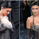 Kylie Jenner po letih ugibanj razkrila podrobnosti povečanja prsi