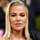 Khloe Kardashian razkrila svoj seznam lepotnih posegov