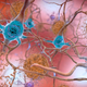 Rešitev za Alzheimerjevo bolezen? Ključ bi se lahko skrival v litiju