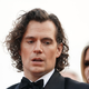 Igralec Henry Cavill se je med snemanjem novega filma huje poškodoval