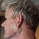 Gordon Ramsay po operaciji: 'Prosim, ne pozabite na kremo za sončenje'