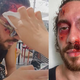 Dina (Skrito v raju) med počinicami v Makarski okrvavljenega posneli v baru (VIDEO)