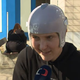Grozljivo - smučarki po hudem padcu manjka del lobanje, delno je paralizirana (foto)