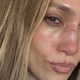 Jennifer Lopez se je hudo poškodovala