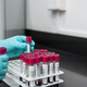 Ob svetovnem dnevu hepatitisa na voljo brezplačno anonimno testiranje