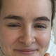 Optimistična Nika Vodan: med okrevanjem navija za dekleta (Suzy)