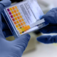 Preprost test urina odpira novo pot za zgodnje odkrivanje raka prostate