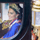 Zaskrbljujoč videz Kate Middleton: »Znak, da ima težave z okrevanjem.«
