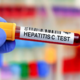 Jani s potovanja prišel okužen s hepatitisom C