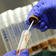 ZARADI NJE LETNO UMRE VEČ KOT 35.000 LJUDI: Sev bakterije E.coli odporen na antibiotike, primerov okužb vse več