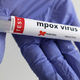 V Severni Makedoniji prva primera okužbe z virusom mpox. Okužena moška nista bila na potovanju