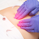 Kako prepoznati znake endometrioze?