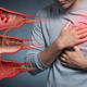 Ali imate zamašene arterije, ne da bi vedeli? Znaki in preventivni ukrepi za ohranjanje zdravih žil