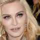 Madonna: Prva fotografija po hospitalizaciji, fani šokirani