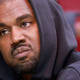 Kanye West si je dal odstraniti zobe, tak je zdaj