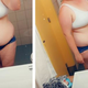 Izgubila 77 kilogramov: Znani Slovenki odstranili več kg kože, takšna je zdaj